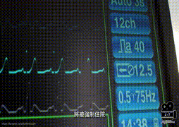 紀律病房-逃藥(片長23分鐘)